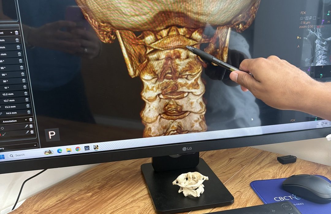 3D image of neck and spine