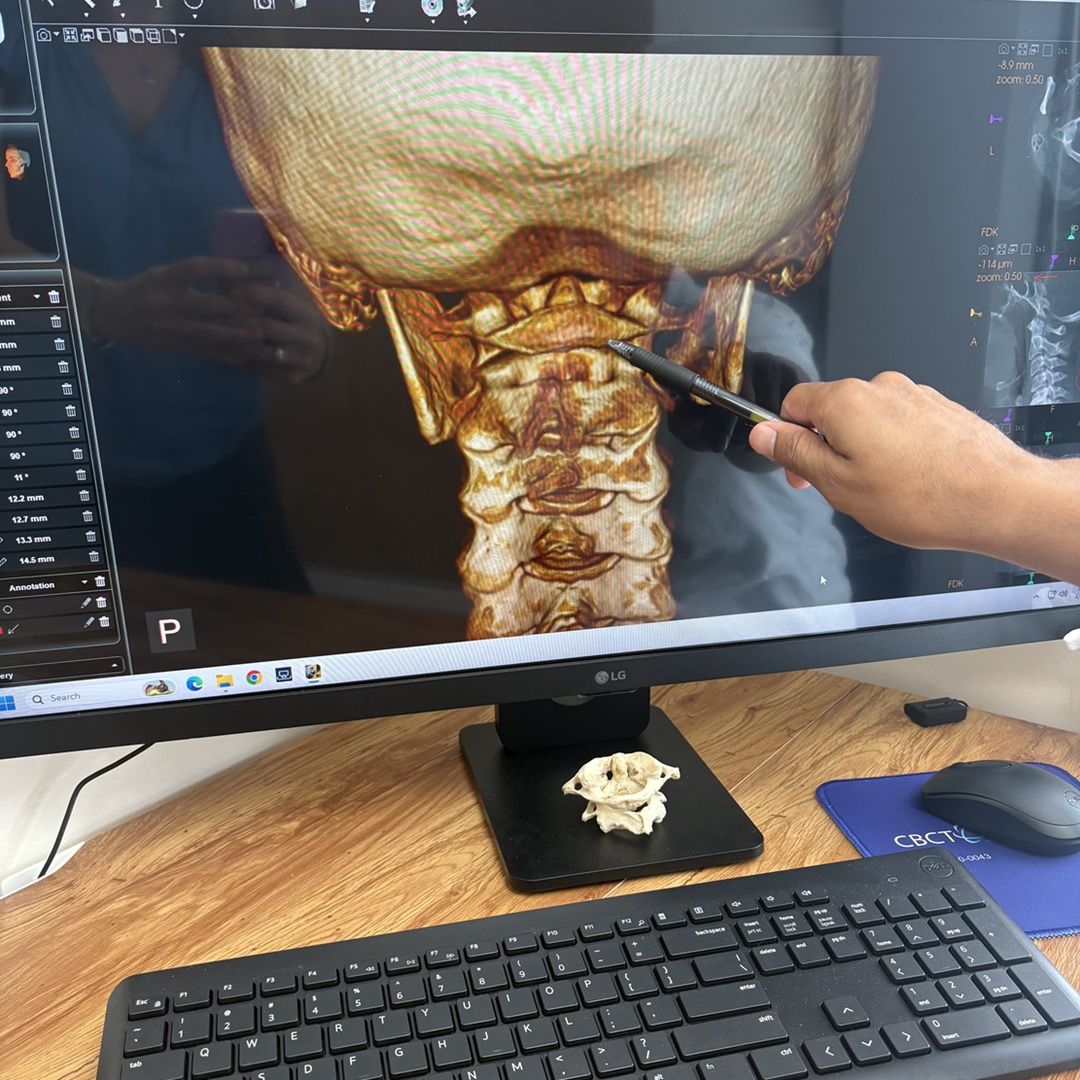 3D image of neck and spine